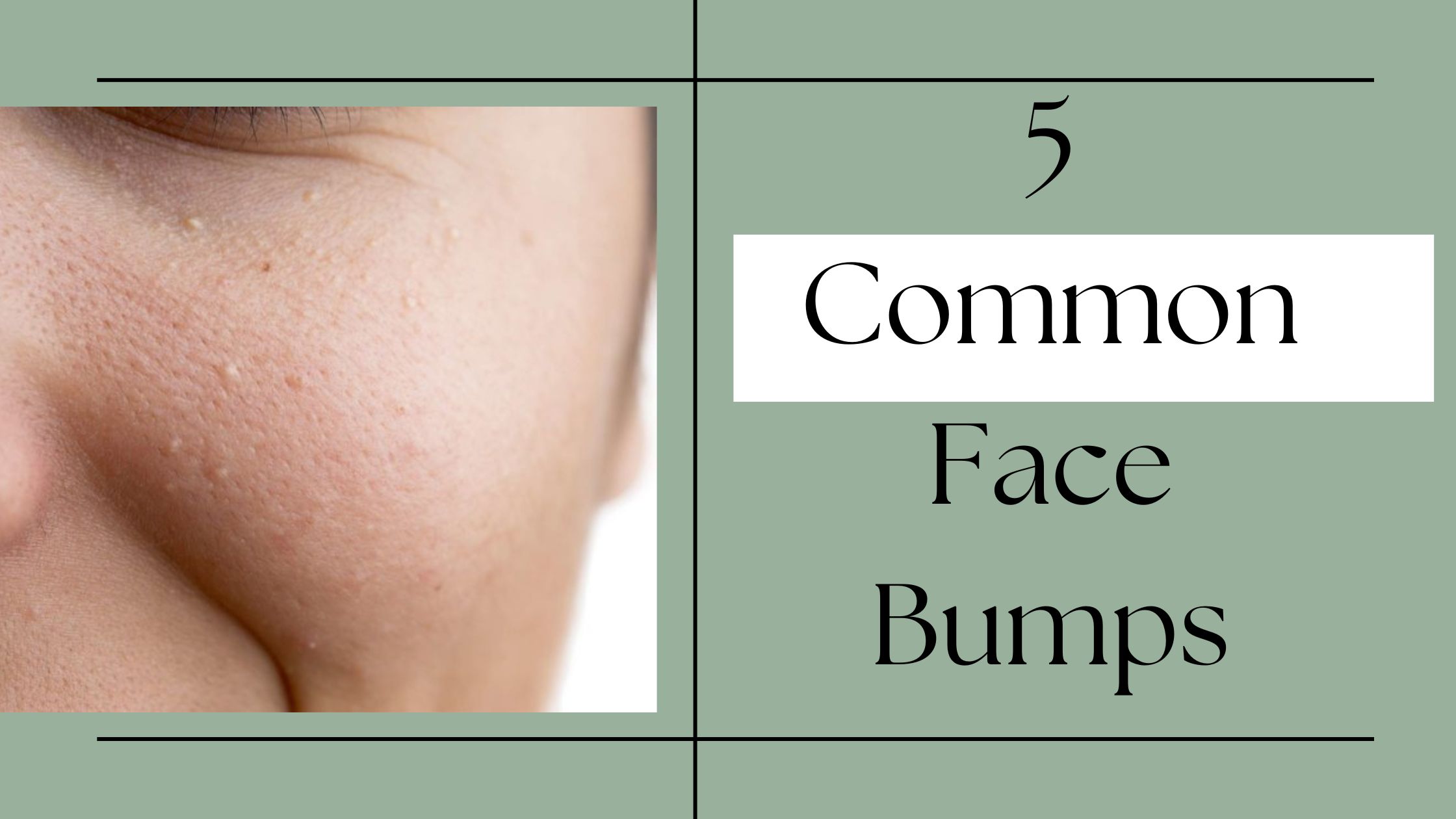 5-common-face-bumps-and-how-to-deal-with-them-flawlessly-fittobeat